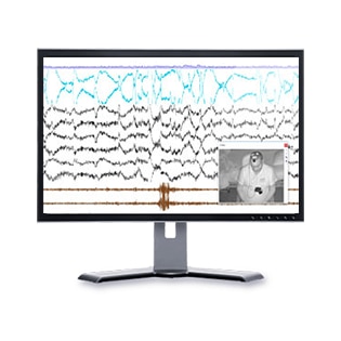 noxturnal-software-nahrávání-video-resmed